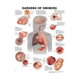   Smoking 20x26 Ea by, Anatomical Chart Company  Industrial