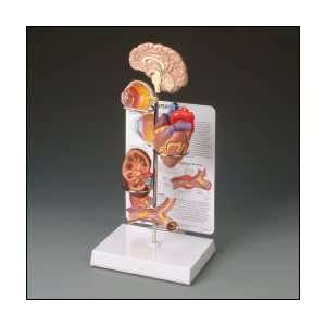 Anatomical Chart Company   Hypertension Model Set  