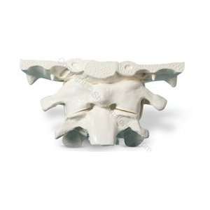   /Axis Cervical Vertebrae Spine Model (Made in USA) 