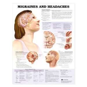 Migraines and Headaches Chart  Industrial & Scientific
